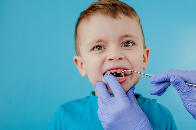 작은 환자는 파란색 벽에 치과 의사의 입을 열고 싶지 않습니다. 치과 의사는 치아를 치료합니다. 치과 의사 사무실에서 어린 소년의 이빨을 치료하는 치과 의사의 뷰를 닫습니다.
