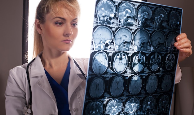 Smart young doctor woman in white labcoat looking through mri of human brain