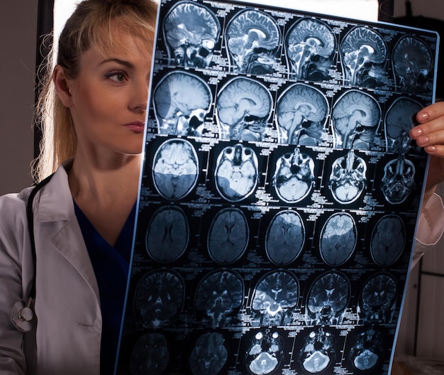 Smart young doctor woman in white labcoat looking through mri of human brain