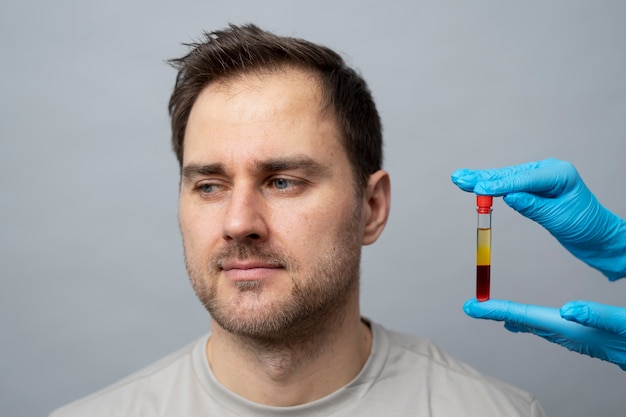 Photo smiley man and hands holding prp vial