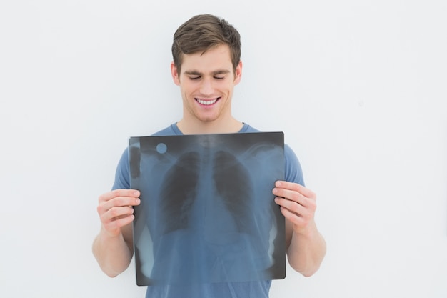 Foto raggi x sorridenti del polmone della holding del giovane