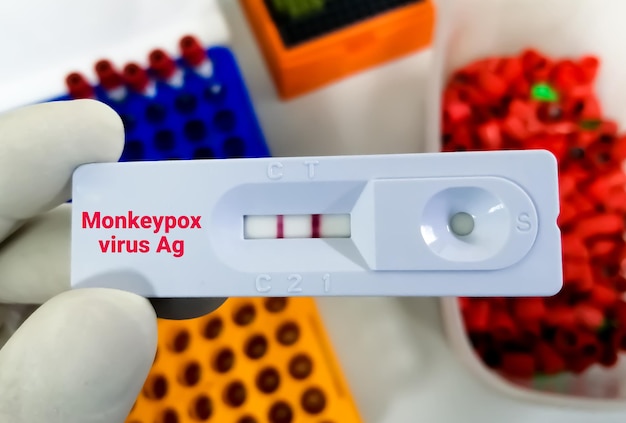 Snelle testcassette voor Monkeypox-virustest