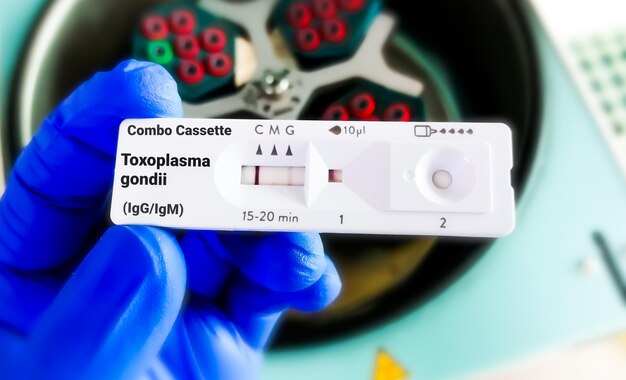 Foto snelle testcassette voor toxoplasma-antilichaamtest toxoplasma gondii