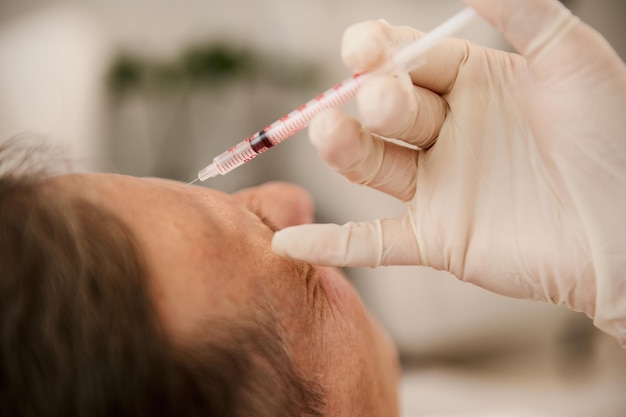 soft focus on a syringe with beauty product on the aesthetician hands in white surgical gloves making injection on the face of middle aged man for rejuvenation and anti-aging treatment in wellness spa