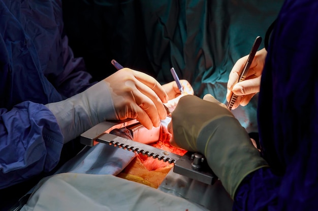 Chirurgo di sfondo naturale morbido durante un'operazione a cuore aperto