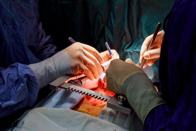 Soft natural background surgeon during an operation on the open heart