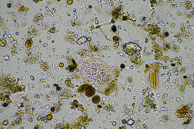 Soil microbes in a compost on a farm in india