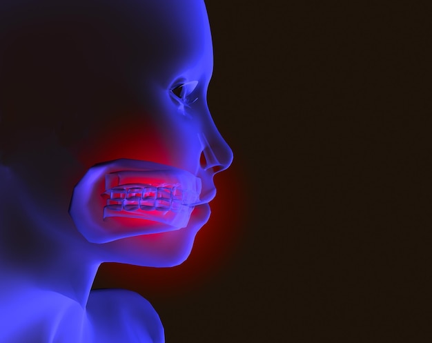 Sore mouth and toothache. 3d image of x-ray of sore mouth and toothache