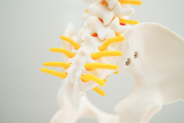 Spinal nerve and bone Lumbar spine displaced herniated disc fragment Model for treatment medical