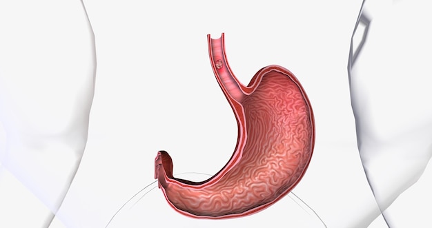 Foto carcinoma a cellule squamose cancro che si forma nelle sottili cellule piatte che rivestono l'interno dell'esofago