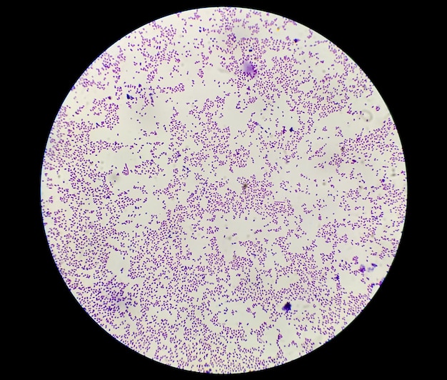 Staphylococcus aureus bacteria colonie gram stain microscopic 100x image