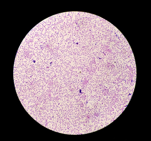 Staphylococcus aureus bacteria colonie gram stain microscopic 100x image