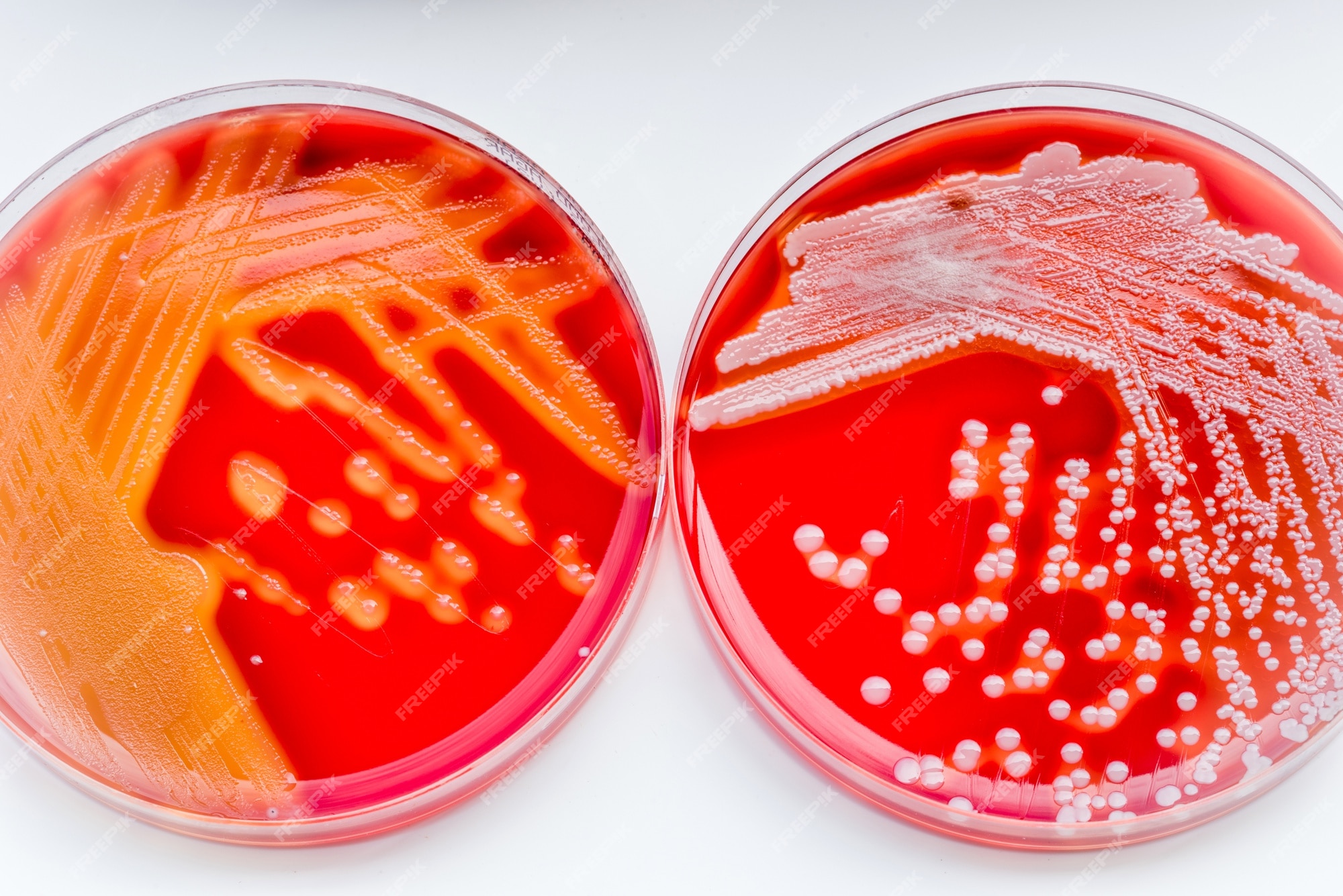 Differences Between Staphylococcus and Streptococcus - Microbiology Info.com