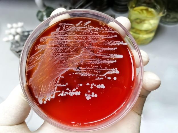 Staphylococcus aureus un tipo di crescita di batteri gram positivi su agar sangue