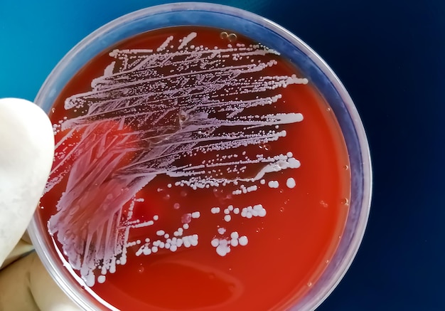 黄色ブドウ球菌は、血液寒天培地でのグラム陽性菌の増殖の一種です。