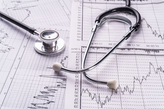 Stethoscope and cardiogram, medical concept.