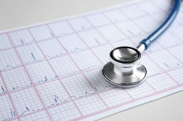 Stethoscope and cardiogram on table