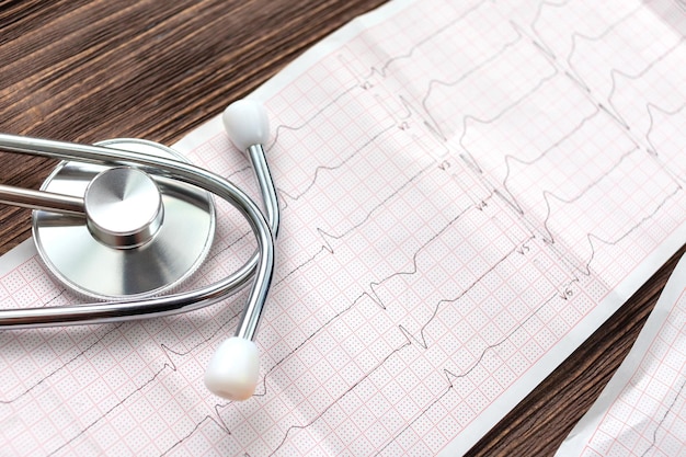 Stethoscope and cardiogram on wood background