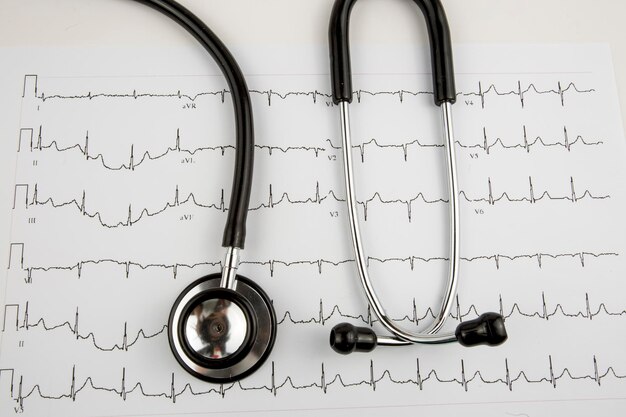 Photo stethoscope on the electrocardiogram (ecg) graph (top view)