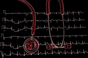 stethoscope on the electrocardiogram (ecg) graph (top view)