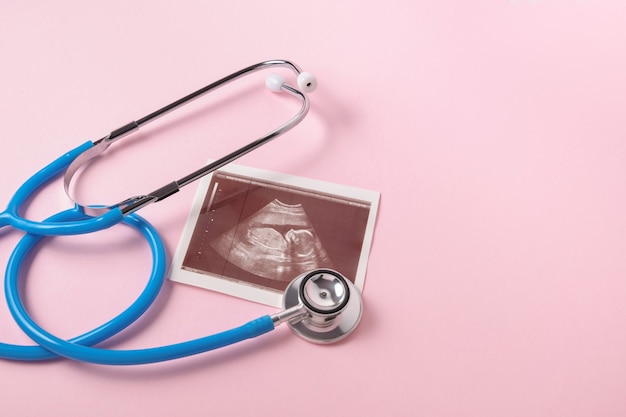Photo stethoscope and ultrasound scan of embryo on pink background, pregnancy concept