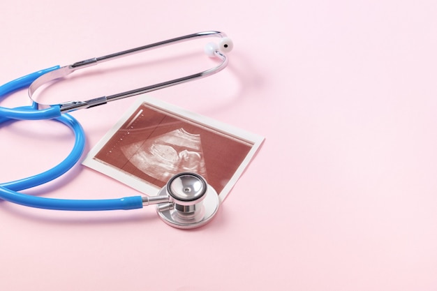 Stethoscope and ultrasound scan of embryo on pink background, pregnancy concept