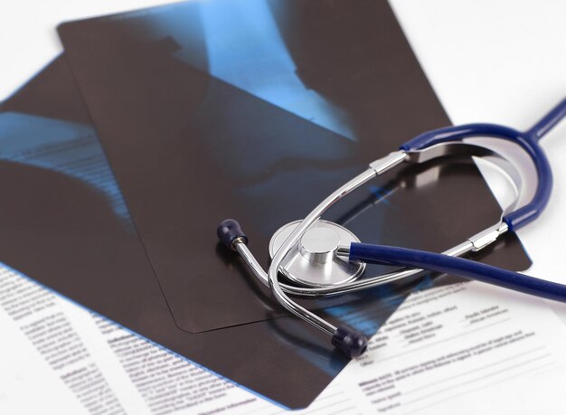 Stethoscope and xrays on a white background