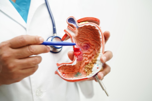 Foto medico delle malattie dello stomaco che tiene il modello anatomico per la diagnosi dello studio e il trattamento in ospedale