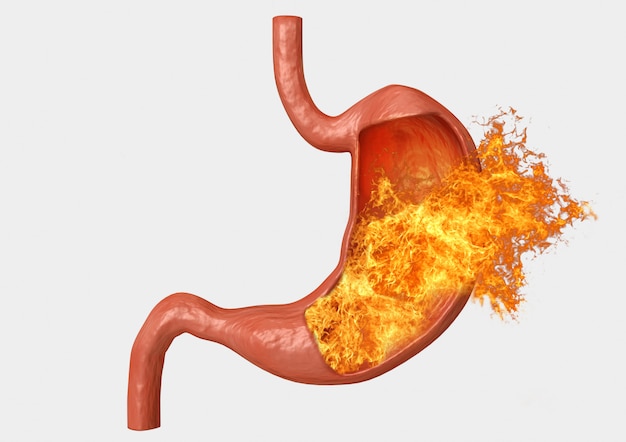 Stomach fire. excessive acidity, indigestion