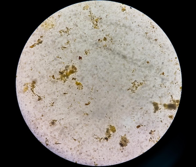 Stool examination under light microscopy. Stool analysis.