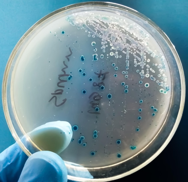 사진 streptococcus pneumoniae: 페트리 접시 배양