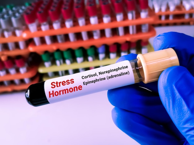 사진 스트레스 호르몬: 코르티솔, 에피네프린, 아드레날린, 노레피네프린은 주요 스트레스호르몬입니다.