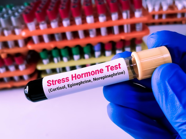 Stresstest Hormonen Cortisol epinefrine adrenaline en norepinefrine zijn de belangrijkste stresshormonen