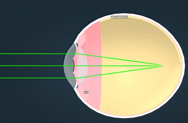 Photo structure of the human eye and anatomy of vision