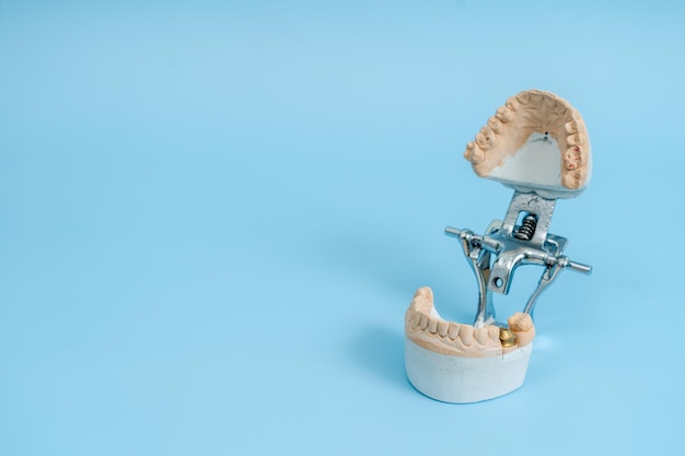 Foto modello di studio di denti e gengive su sfondo blu concetto dentale