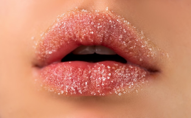 설탕 뷰티 트리트먼트 립케어 화장품으로 설탕 입술 클로즈업 립