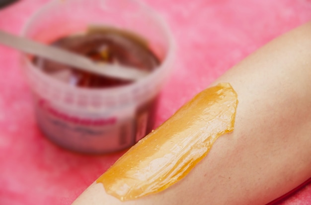 Sugaring epilation