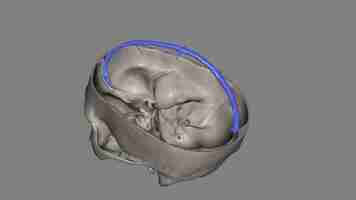 Photo the superior sagittal sinus within the human head is an unpaired area along the attached margin of the falx cerebri