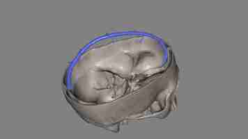 Photo the superior sagittal sinus within the human head is an unpaired area along the attached margin of the falx cerebri