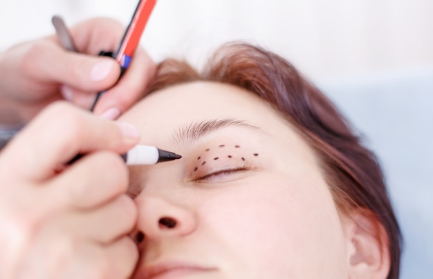 Surgeon correcting female face before the operation