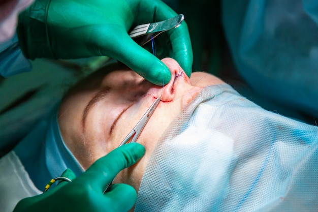 Surgeon and his assistant performing cosmetic surgery on nose in hospital operating room. Nose reshaping, augmentation. Rhinoplasty.