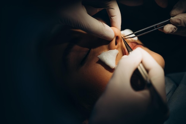 Surgeon and his assistant performing cosmetic surgery on nose in hospital operating room Nose reshaping augmentation Rhinoplasty