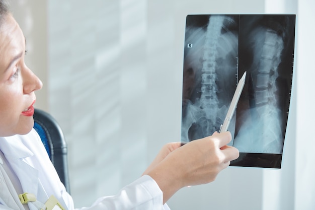 척추 x- 레이에서 가리키는 외과 의사