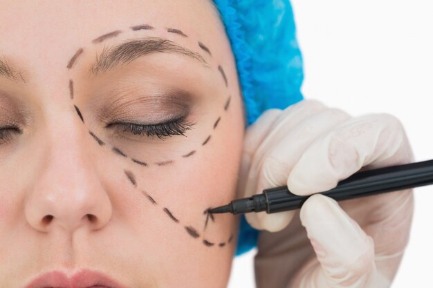 Surgeon writing on the serious woman&#039;s face