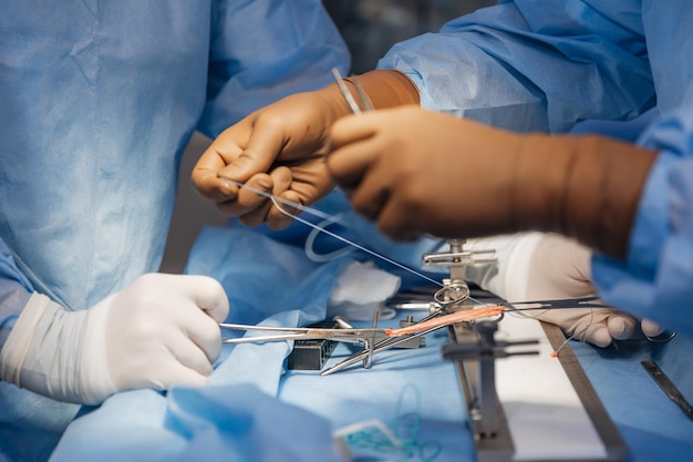 surgeons work on the cut part of the knee joint muscular ligament before implanting it back into the patients knee