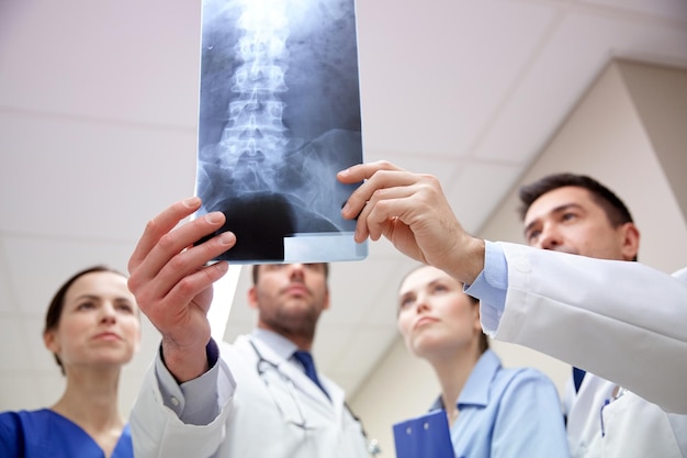 surgery, people, healthcare and medicine concept - group of medics with spine x-ray scan at hospital