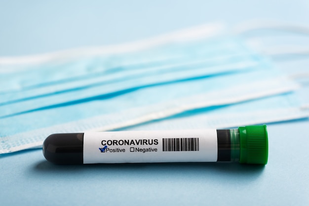 Photo surgical mask with positive coronavirus test tube. coronavirus protection concept (covid19). medical respiratory mask.