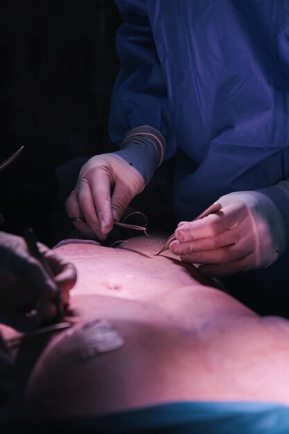 Suturing during surgery