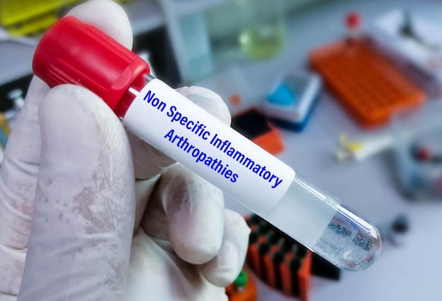 Synovial fluid for Undifferentiated arthritis for Non Specific Inflammatory Arteriopathies Test.