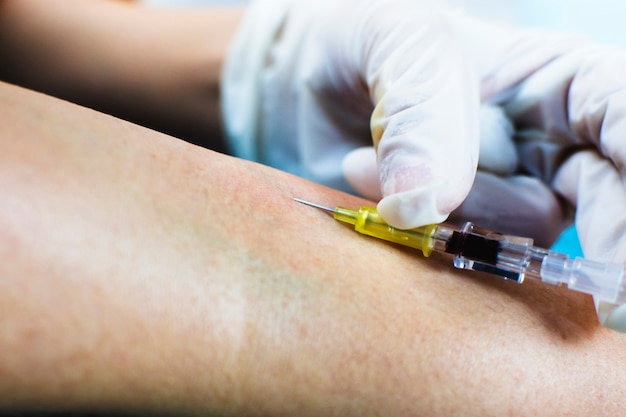 Syringe injecting into a vein on the arm of patient.